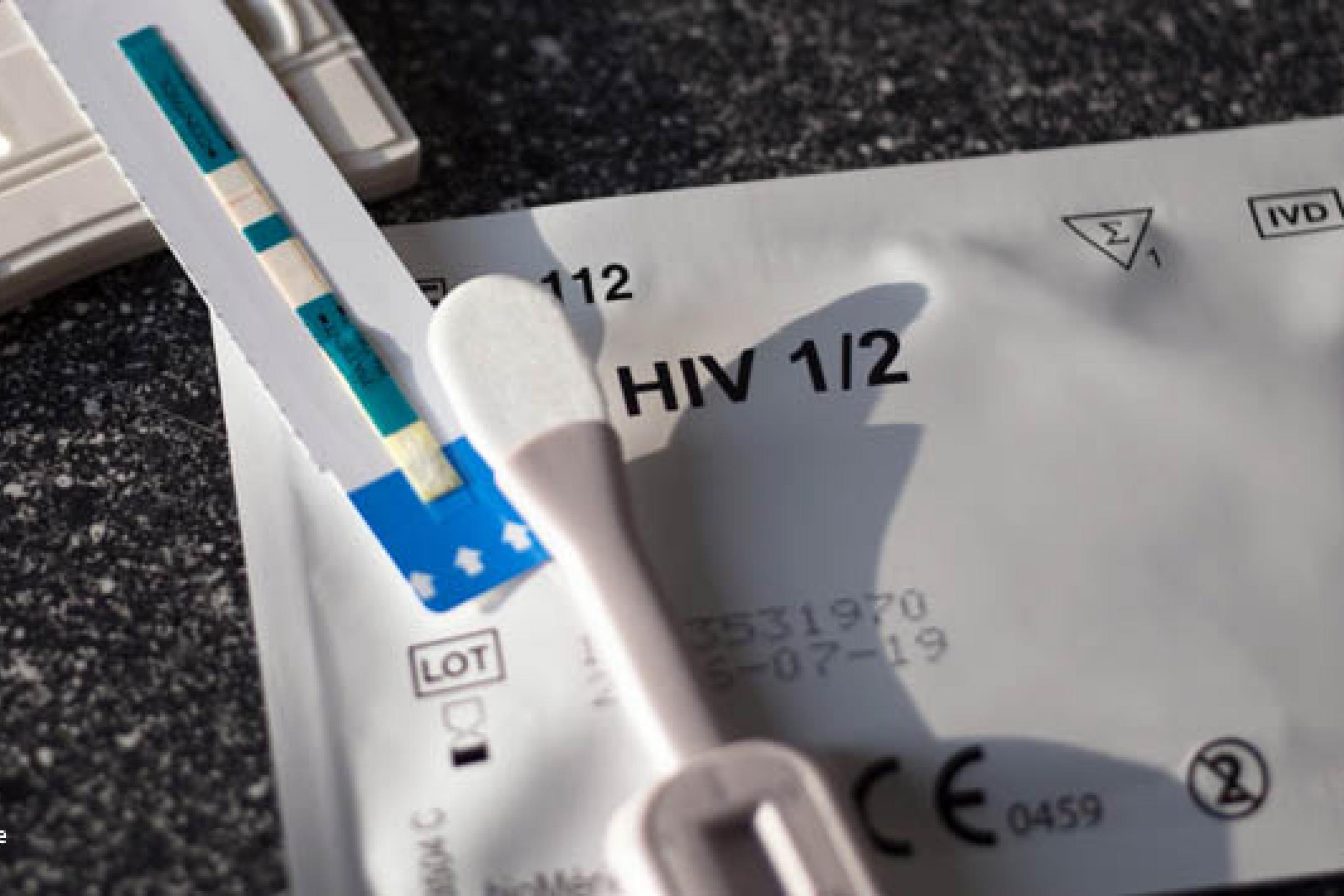 Partner hiv man wenn kann hat bekommen kein hiv Aids: Sex