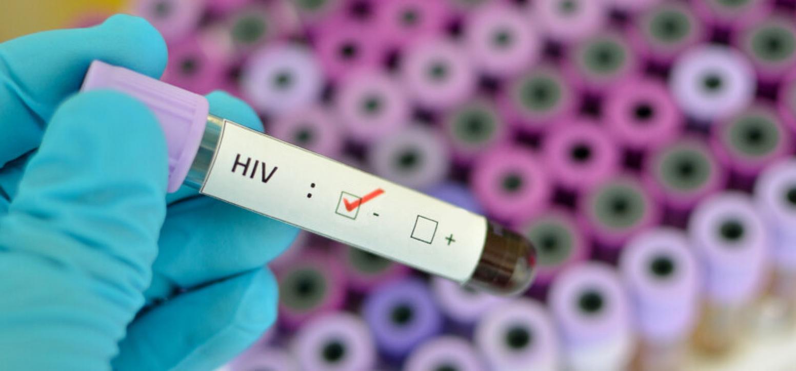 HIV negativ